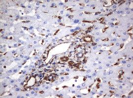 VIM Antibody in Immunohistochemistry (Paraffin) (IHC (P))