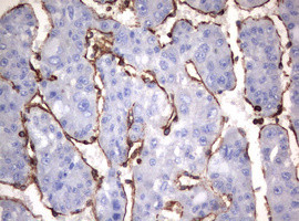 VIM Antibody in Immunohistochemistry (Paraffin) (IHC (P))