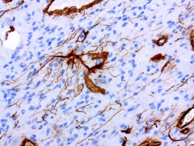 VIM Antibody in Immunohistochemistry (Paraffin) (IHC (P))