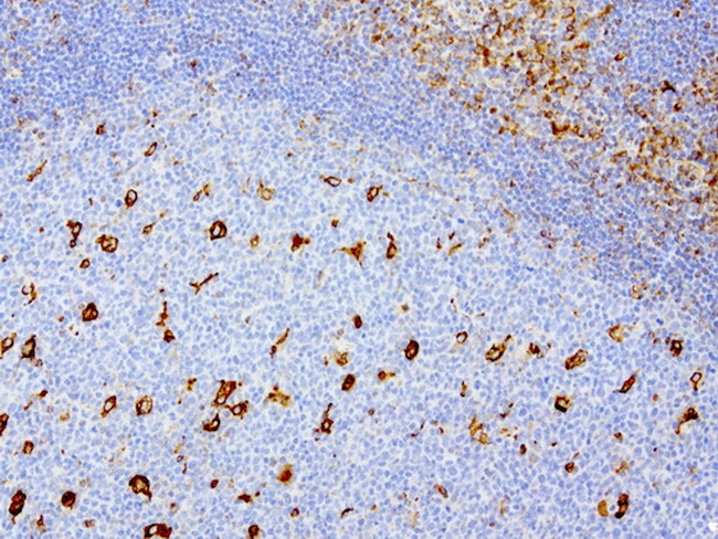 VIM Antibody in Immunohistochemistry (Paraffin) (IHC (P))