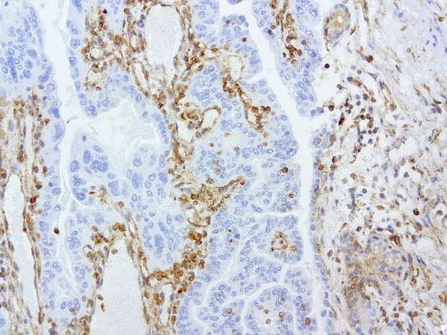 VIM Antibody in Immunohistochemistry (Paraffin) (IHC (P))