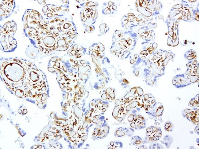 VIM Antibody in Immunohistochemistry (Paraffin) (IHC (P))