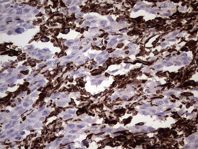 VIM Antibody in Immunohistochemistry (Paraffin) (IHC (P))