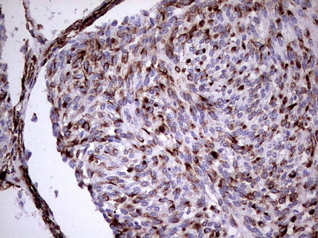 VIM Antibody in Immunohistochemistry (Paraffin) (IHC (P))