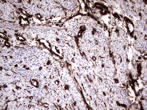 VIM Antibody in Immunohistochemistry (Paraffin) (IHC (P))