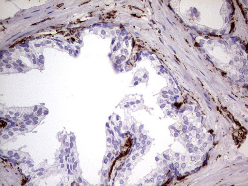 VIM Antibody in Immunohistochemistry (Paraffin) (IHC (P))