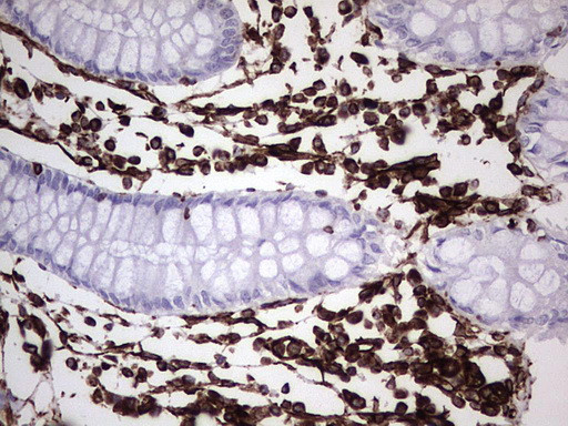 VIM Antibody in Immunohistochemistry (Paraffin) (IHC (P))