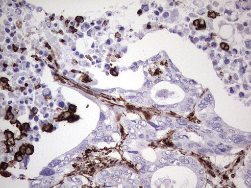 VIM Antibody in Immunohistochemistry (Paraffin) (IHC (P))