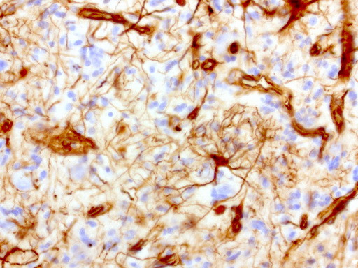 VIM Antibody in Immunohistochemistry (Paraffin) (IHC (P))