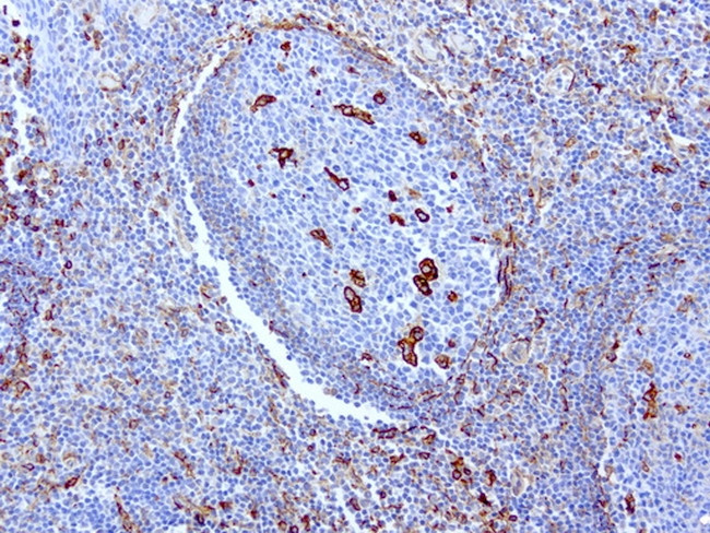 VIM Antibody in Immunohistochemistry (Paraffin) (IHC (P))