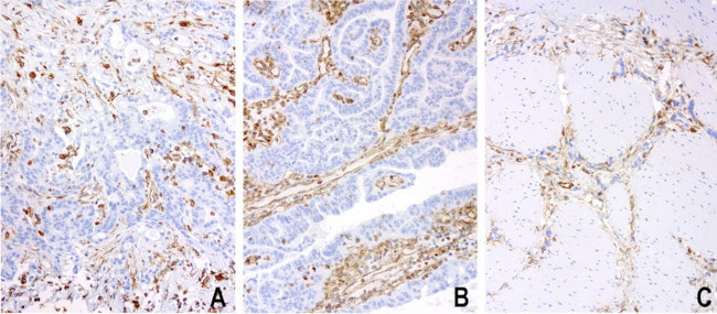 VIM Antibody in Immunohistochemistry (Paraffin) (IHC (P))