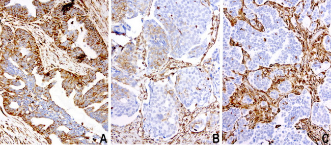 VIM Antibody in Immunohistochemistry (Paraffin) (IHC (P))