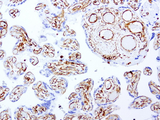 VIM Antibody in Immunohistochemistry (Paraffin) (IHC (P))