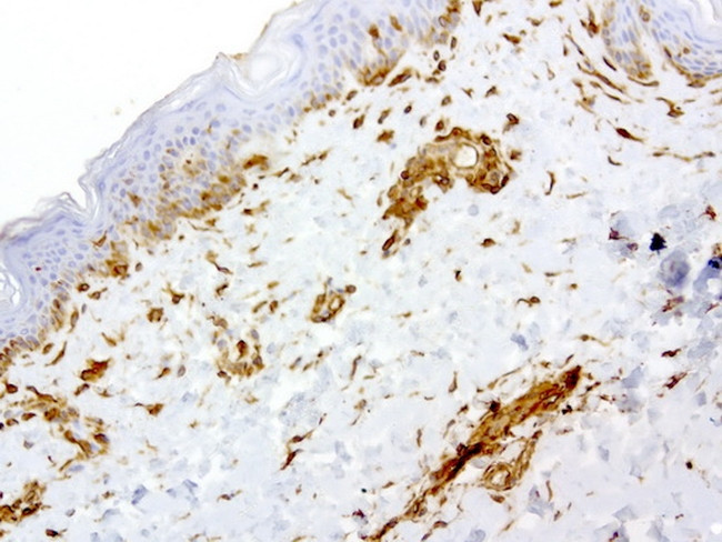 VIM Antibody in Immunohistochemistry (Paraffin) (IHC (P))