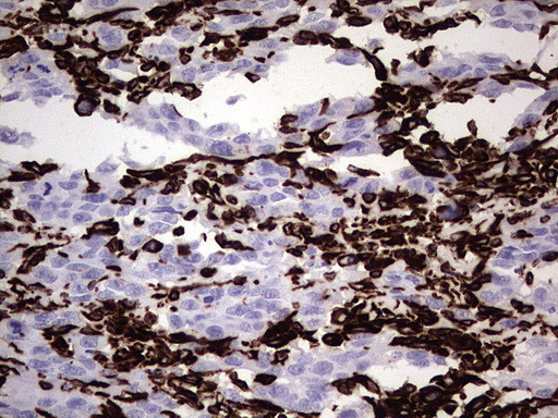 VIM Antibody in Immunohistochemistry (Paraffin) (IHC (P))