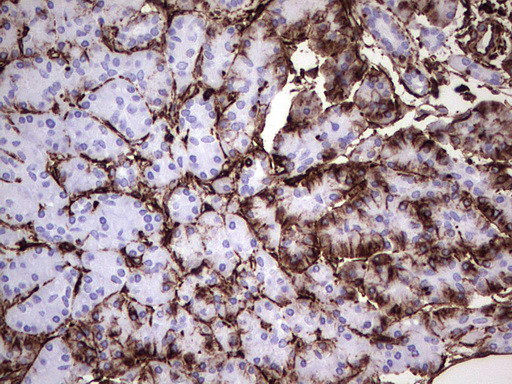 VIM Antibody in Immunohistochemistry (Paraffin) (IHC (P))