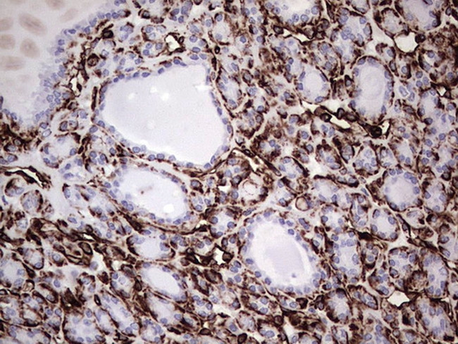 VIM Antibody in Immunohistochemistry (Paraffin) (IHC (P))