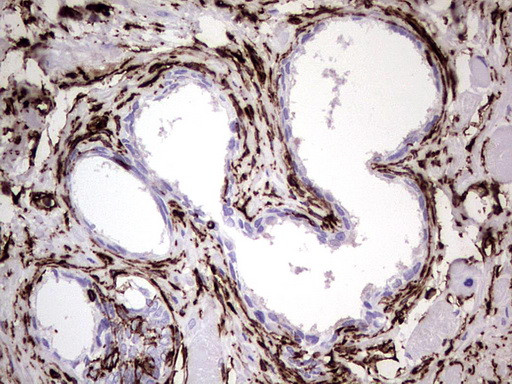 VIM Antibody in Immunohistochemistry (Paraffin) (IHC (P))