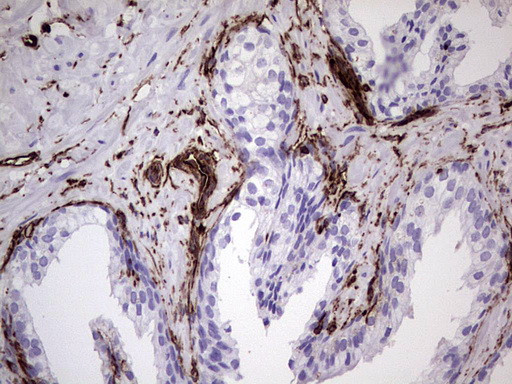 VIM Antibody in Immunohistochemistry (Paraffin) (IHC (P))