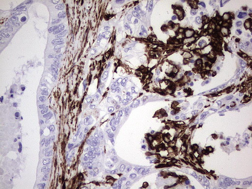 VIM Antibody in Immunohistochemistry (Paraffin) (IHC (P))