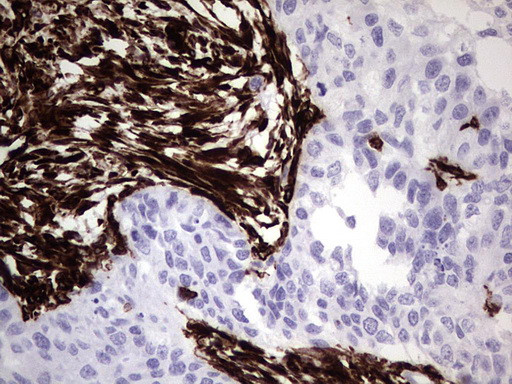 VIM Antibody in Immunohistochemistry (Paraffin) (IHC (P))