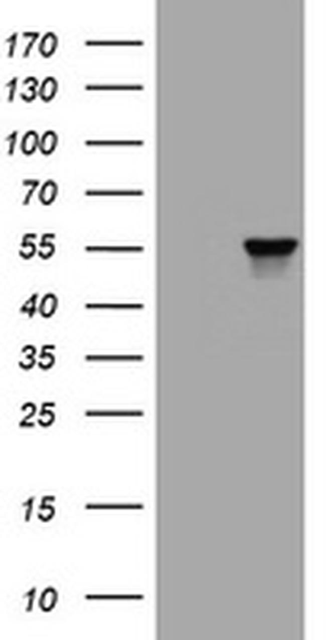 VIM Antibody in Western Blot (WB)