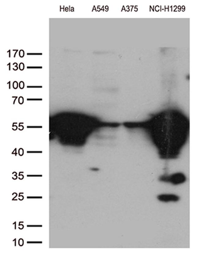 VIM Antibody in Western Blot (WB)