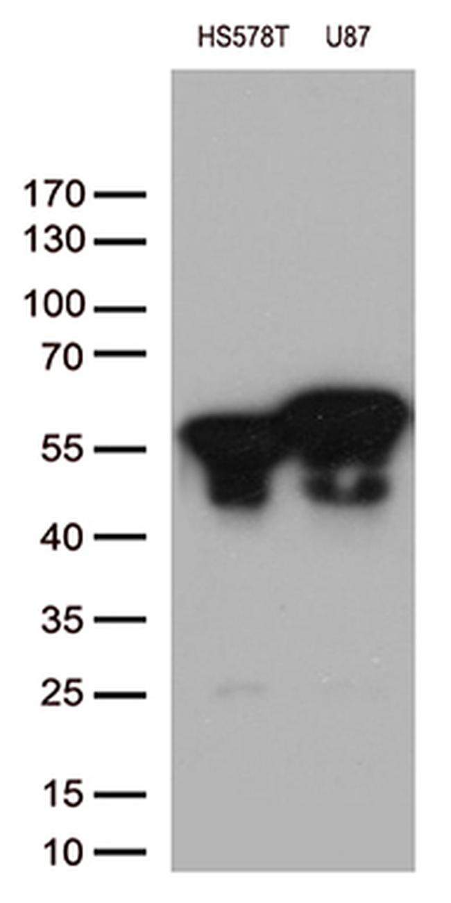 VIM Antibody in Western Blot (WB)