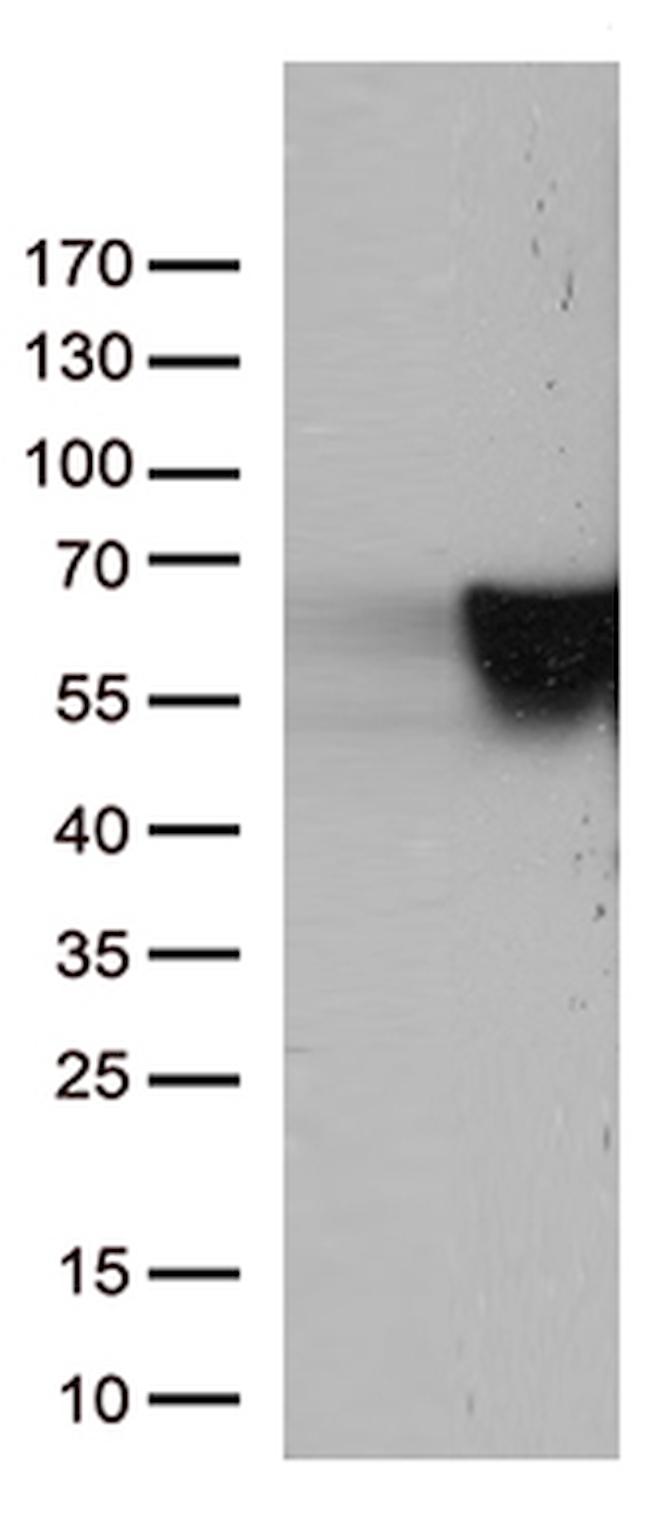 VIM Antibody in Western Blot (WB)