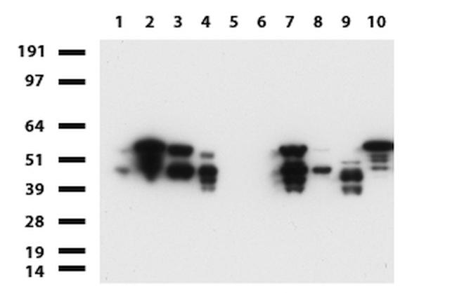 VIM Antibody in Western Blot (WB)