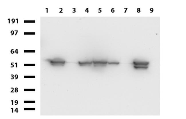 VIM Antibody in Western Blot (WB)