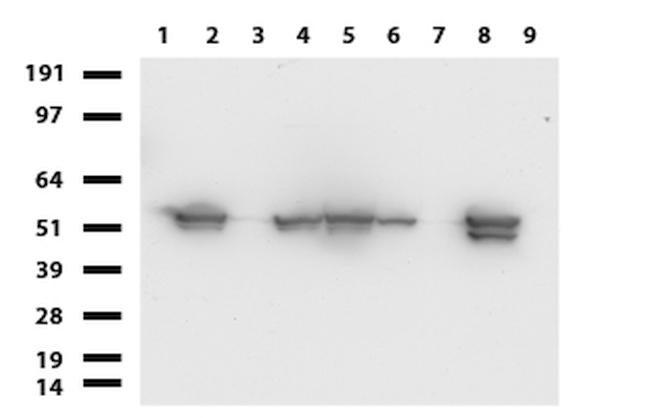 VIM Antibody in Western Blot (WB)