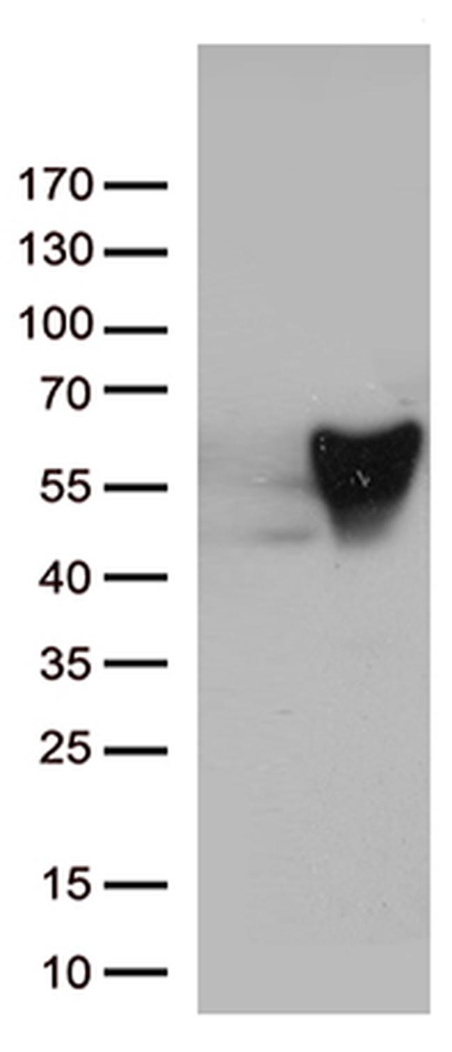 VIM Antibody in Western Blot (WB)