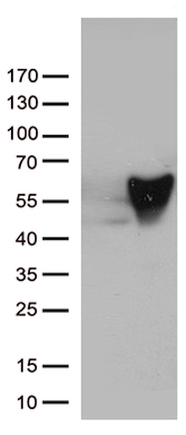 VIM Antibody in Western Blot (WB)