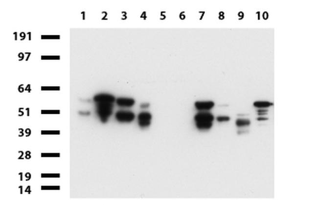 VIM Antibody in Western Blot (WB)