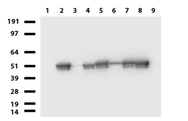 VIM Antibody in Western Blot (WB)