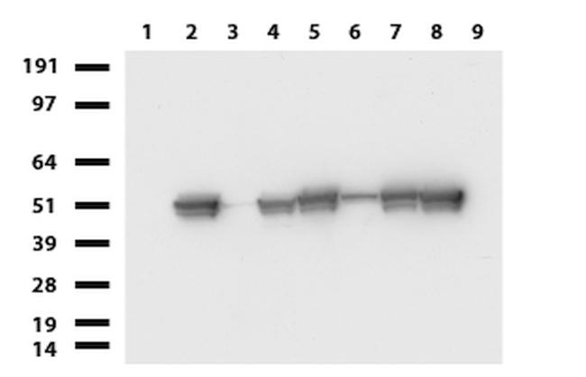 VIM Antibody in Western Blot (WB)