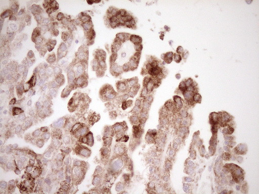 VIP Antibody in Immunohistochemistry (Paraffin) (IHC (P))