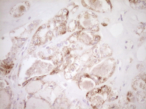 VIP Antibody in Immunohistochemistry (Paraffin) (IHC (P))