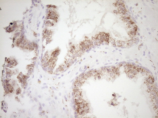 VIP Antibody in Immunohistochemistry (Paraffin) (IHC (P))