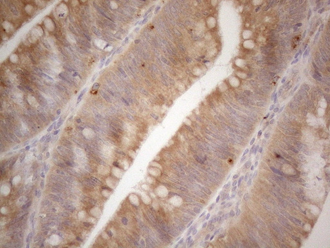 VIP Antibody in Immunohistochemistry (Paraffin) (IHC (P))