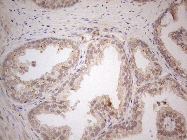 VIP Antibody in Immunohistochemistry (Paraffin) (IHC (P))