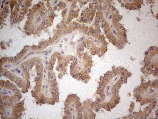 VIP Antibody in Immunohistochemistry (Paraffin) (IHC (P))