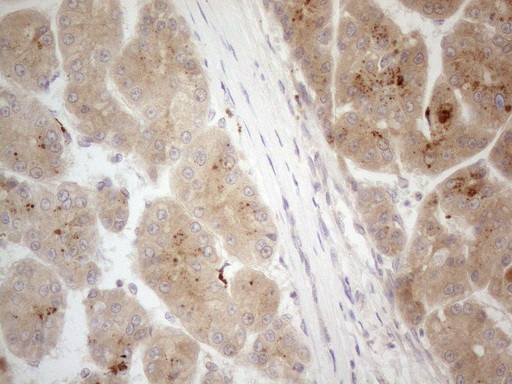 VIP Antibody in Immunohistochemistry (Paraffin) (IHC (P))