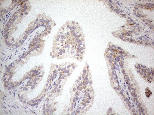 VIP Antibody in Immunohistochemistry (Paraffin) (IHC (P))