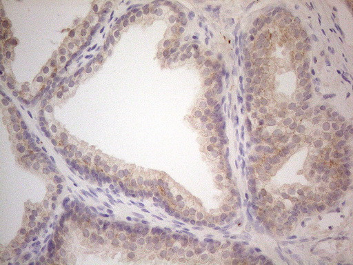 VIP Antibody in Immunohistochemistry (Paraffin) (IHC (P))