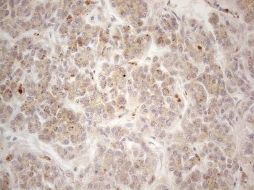 VIP Antibody in Immunohistochemistry (Paraffin) (IHC (P))