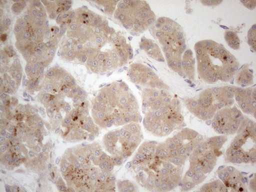 VIP Antibody in Immunohistochemistry (Paraffin) (IHC (P))