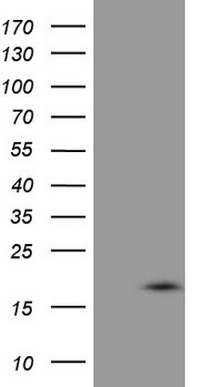 VIP Antibody in Western Blot (WB)