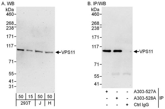 VPS11 Antibody in Western Blot (WB)